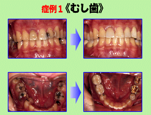 綺麗な歯へのABC