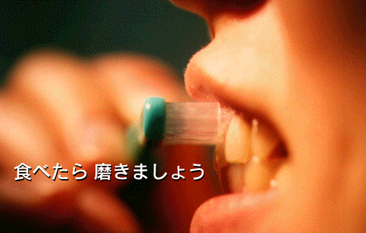 プラークコントロール